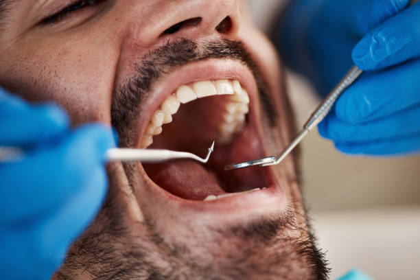 Best Emergency Broken Tooth Repair in Lindsay, OK